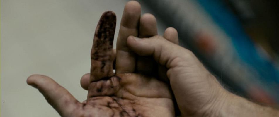 A person's hand with a black mark on it, possibly from a splinter obtained at a gas station.